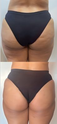 Protocolo Summer 2026